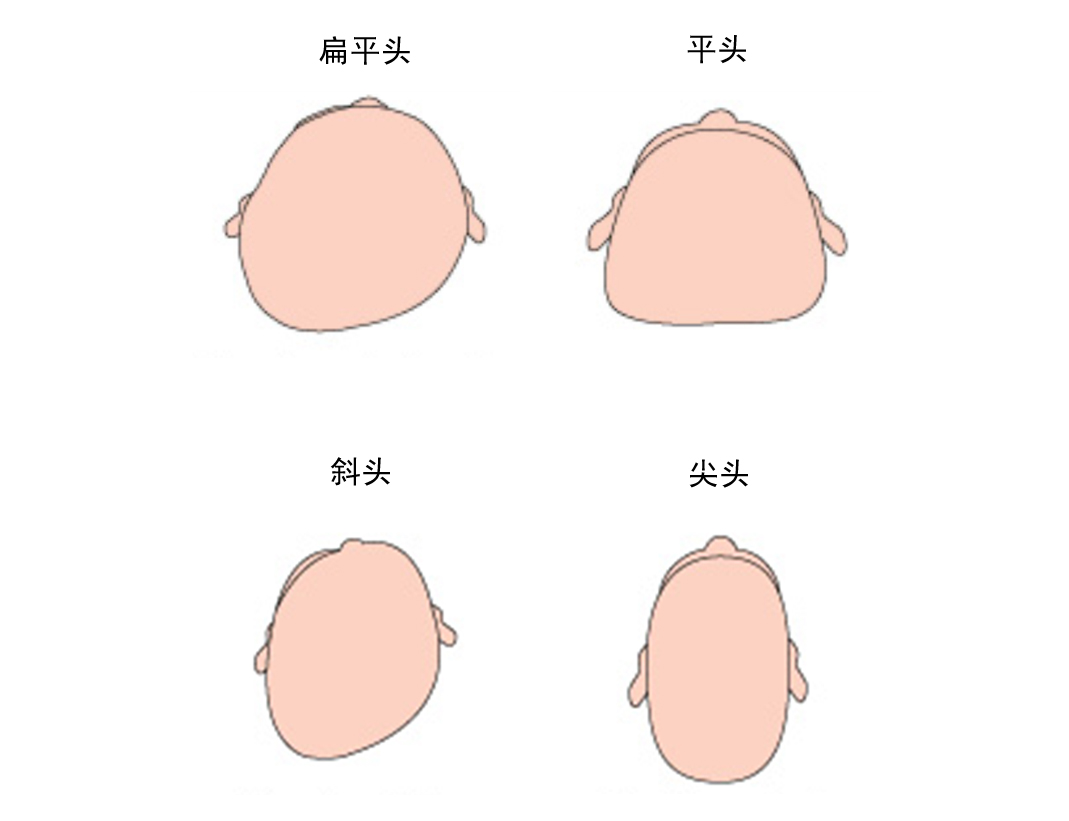 圆头PK扁头，睡头型也有黄金期，再不重视就晚了！__财经头条