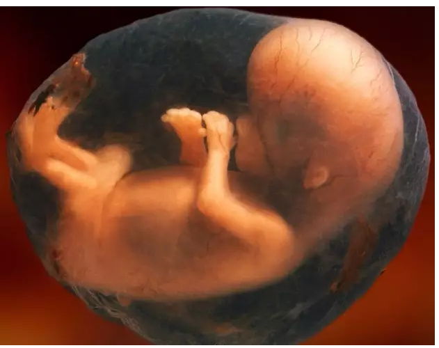 占全部妊娠的10~15%所谓自然流产是指怀孕不足28周,胎儿体重不足1kg