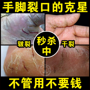 香港虎镖红花冻伤膏冻疮膏冻手脚防冻霜护手霜