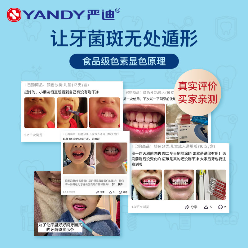 플라크 표시기 치석 색상 인공물 얼룩을 감지하는 어린이 및 성인을 위한 YANDI 치과 플라크 디스플레이 에이전트-