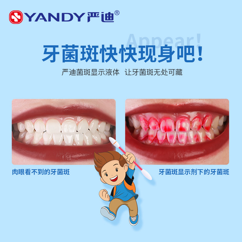 플라크 표시기 치석 색상 인공물 얼룩을 감지하는 어린이 및 성인을 위한 YANDI 치과 플라크 디스플레이 에이전트-