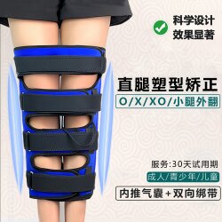 O-Shaped Leg Correction Device, Calf Valgus, X-Shaped Leg Correction, Bow Legs, X-Shaped Children's Inward Slanting Leg Brace, Straight Leg O-Shaped Leg Correction Device, Calf Valgus, X-Shaped Leg Correction, Bow Legs, X-Shaped Children's Inward Slanting Leg Brace, Straight Leg