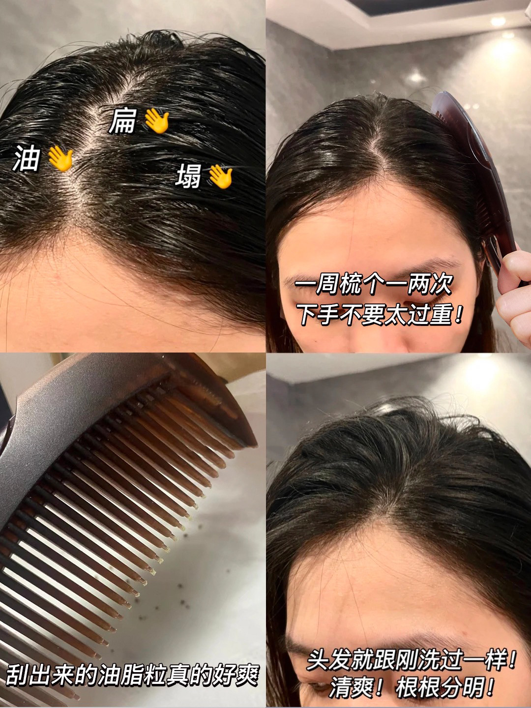 오일헤드 에너지 빗 두피 중공 빗 3,4세대 노워시 헤어 에어백 마사지로 기름기와 비듬 청소 빗 -