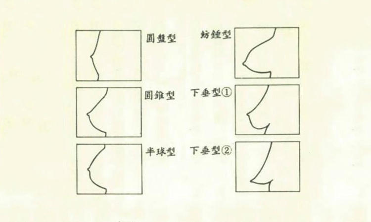 ④纺锤形:底围不大,乳房隆起高,有点向前突出且稍有垂态.