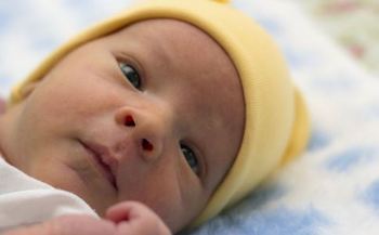早产儿黄疸正常值是多少宝妈必须知道的