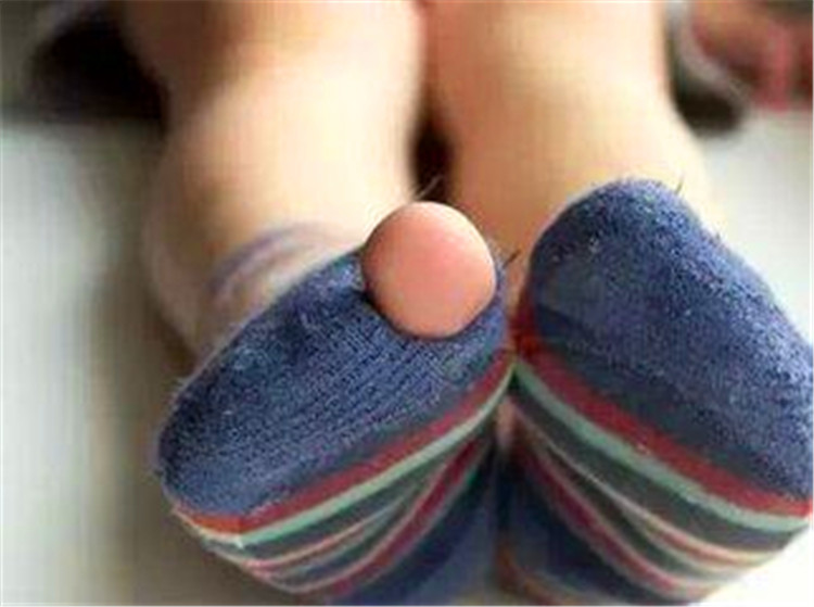 一般状况大拇指是5个脚趾头中最杰出的,也是厚度比较大的,脚指甲盖也