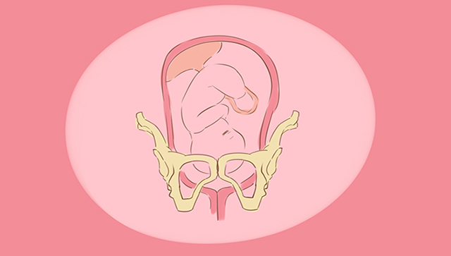 出现这5种感觉说明胎儿已经入盆