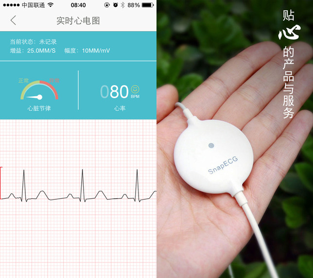 掌上心电监护心率监护仪snapecg便携心电图机 智能穿戴心脏监测仪