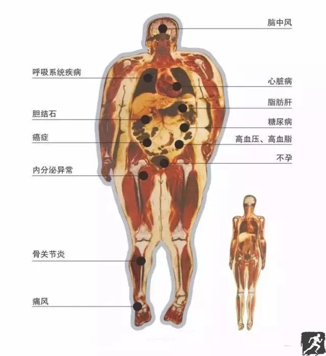 胖人的脂肪解剖图图片