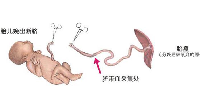 剪脐带的详细过程图片