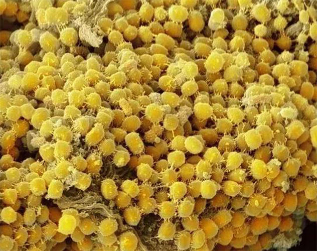 这张图片表明了牙齿上附着着大量的yellow-coloured细菌,或者也有可能
