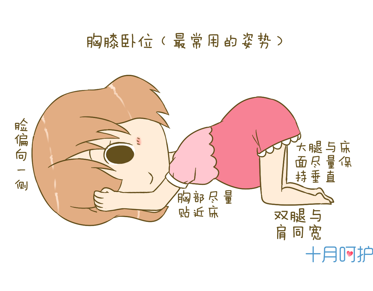 胎位不正,要顺产跟我左手右手一个慢动作