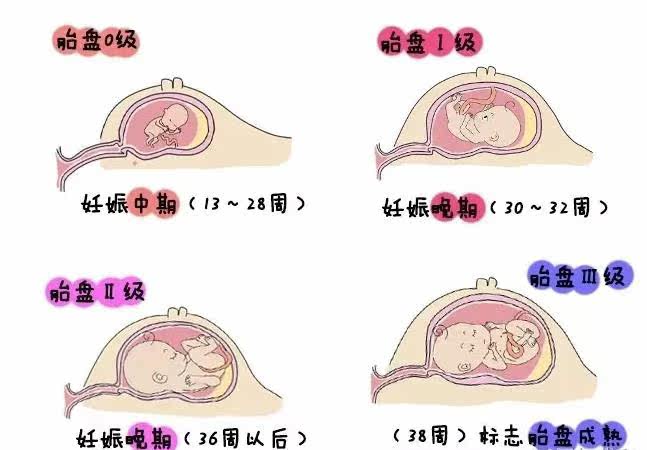 这么看b超检查单,你便知肚里胎儿是否健康了!