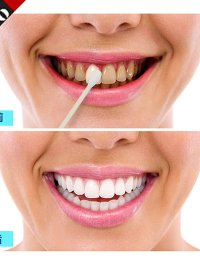 洁白牙白粉 去黄牙牙齿美白速效黄牙洗牙粉洗牙去渍渍粉牙烟男女