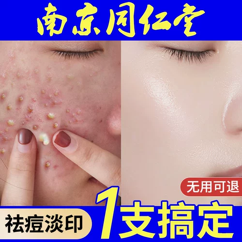 Tongrentang, осветляющий восстанавливающий крем подходит для мужчин и женщин, гель, анти-акне, скрывает прыщи