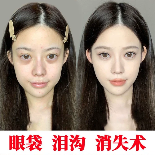 [Доуйин горячие пакеты с глазами глаз разрываются, исчезнуть, чтобы разрываться, мы можем использовать разрыв слезы, чтобы уменьшить мешки для мужчин и женщин ~