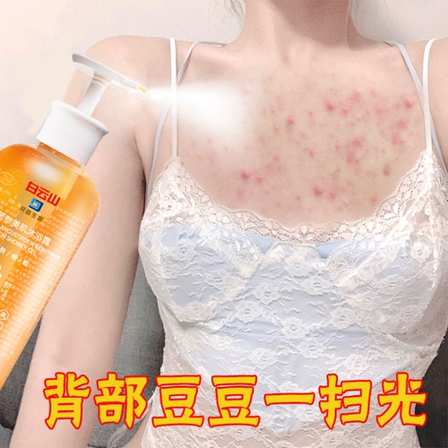 [Xiaohongshu Hot Sales] Не делайте заднюю часть Doudou Back Doudou и не говорите, что на спине нет бобов, и покупайте один волос за три ~