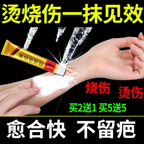 Специальный эффект ожоги и ожоги мази, сварочный огонь, влажное масло, кипячему воду, ожоги, ожоги кожи, ожоги
