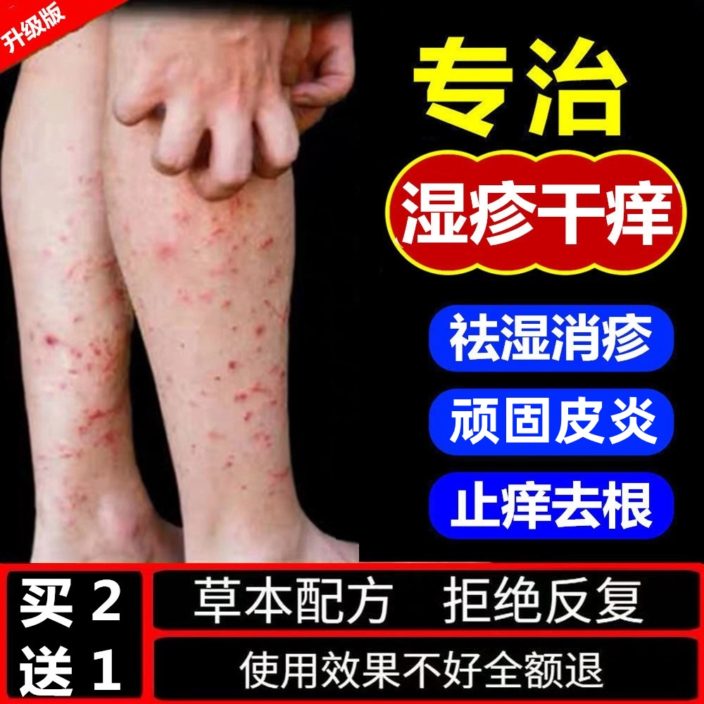 顽固小腿全身慢性湿疹皮肤干燥瘙痒湿痒抑菌外用百草止痒药膏去根 Taobao