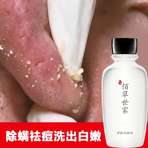 Увлажняющее очищающее молочко на основе аминокислот от черных точек, анти-акне, сужает поры, контроль жирного блеска