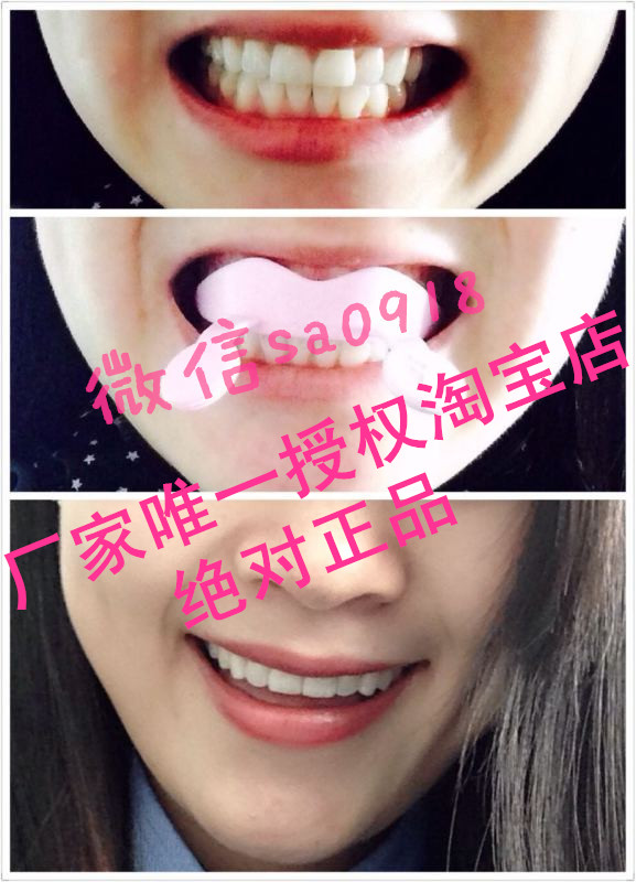 

Прибор для подтяжки лица Moria