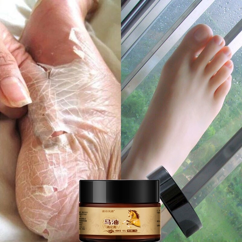 [Купить 1 Получить 1 Получить 1, купить 2 Получить 3 Получить 3] прикосновение восстановления нежных каблуков и ноги макаро легко рекомендовать