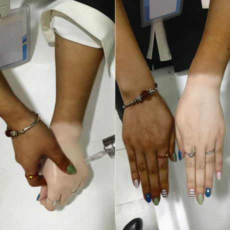 【皮肤晒黑,天生黑,暗黄】全身美白学生脖子手臂腿脸部长久变白