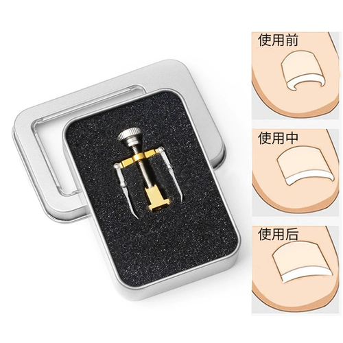 Ортезы для пальцев на ноге, носки, комплект