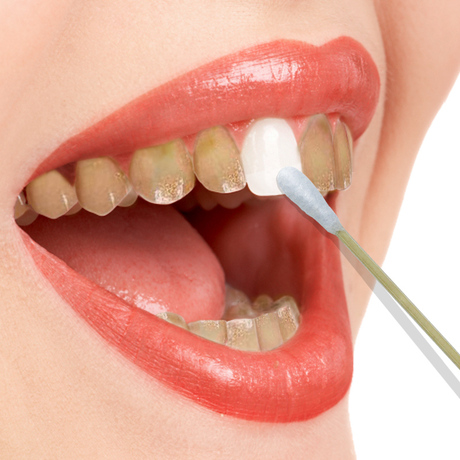 牙齿白白白 微微一笑很倾城 回眸一笑百媚生