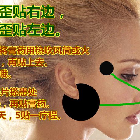 面瘫贴 口眼喎斜 面肌痉挛 歪嘴巴 吊线风 面瘫后遗症贴 5件包邮