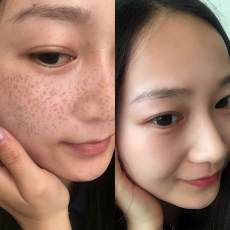 爱逛街为您找到美白祛斑霜相关的宝贝,您可以在下面的板块中挑选喜欢