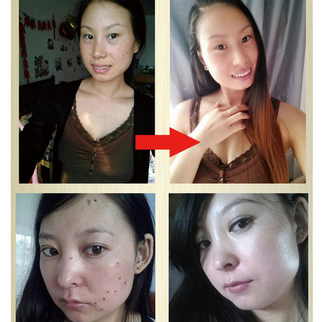 【质检权威认证】去黑点 脸部全身淡斑 美容金水