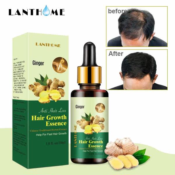 Lianbiquan Lanthome имбирь волосы шампунь жидкость  30ml Ginger Hair Growth Serum