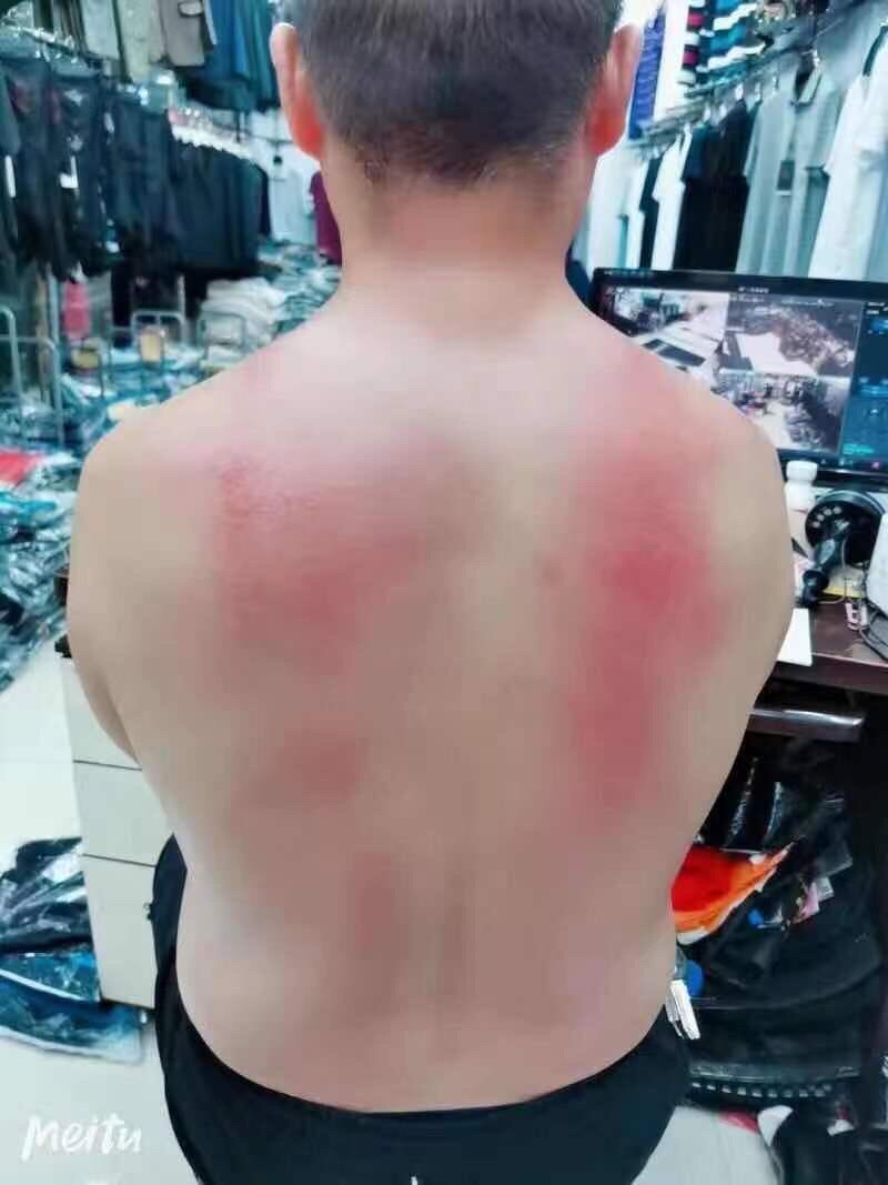 家用无线充电款刮痧仪器负压引力操盘手电动拔罐理疗仪经络刮痧仪