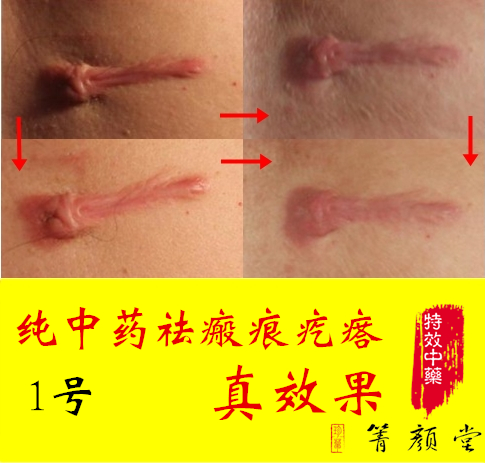 

Jean Cao Jing Yan Tang