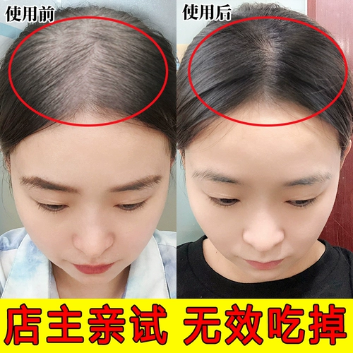 [Не растут, я ем] естественные темпы роста волос становится плотным для мужчин и женщин в волосах