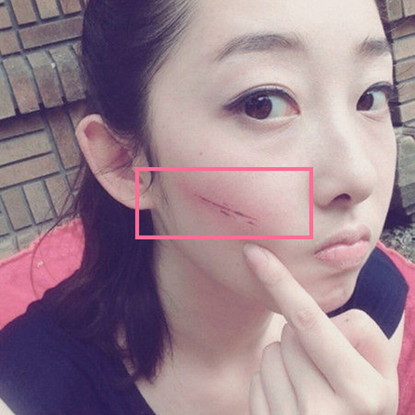 正品疤痕灵淡疤海藻修复膏产品淡化疤痕凹凸疤去除手术疤祛伤疤克