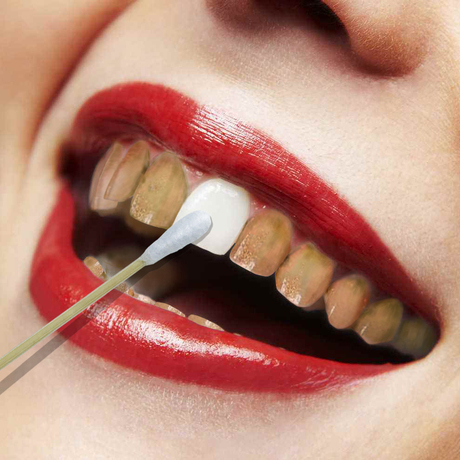 牙齿白白白 微微一笑很倾城 干干净净很迷人