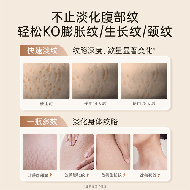 Kangaroo Mom Pregnancy Oil Pregnant Women Preventing and Fading Lines Double Extract Small Golden Bottle Essence