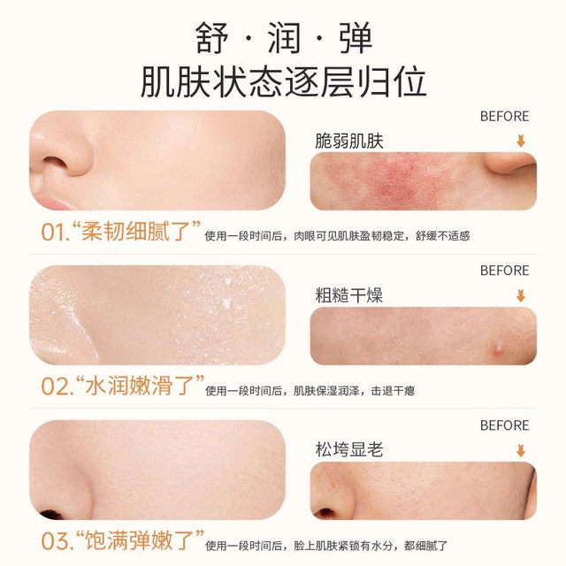 Neulebao Algae Water Lotion Set Squalane Anti-Wrinkle Soothing Moisturizing Mother Skin Care Official Flagship Store Niulebao