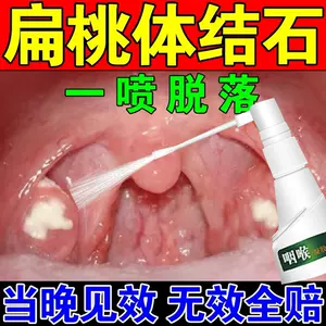 扁桃体口臭 新人首单立减十元 22年4月 淘宝海外 扁桃体口臭 新人首单立减十元 22年4月 淘宝海外