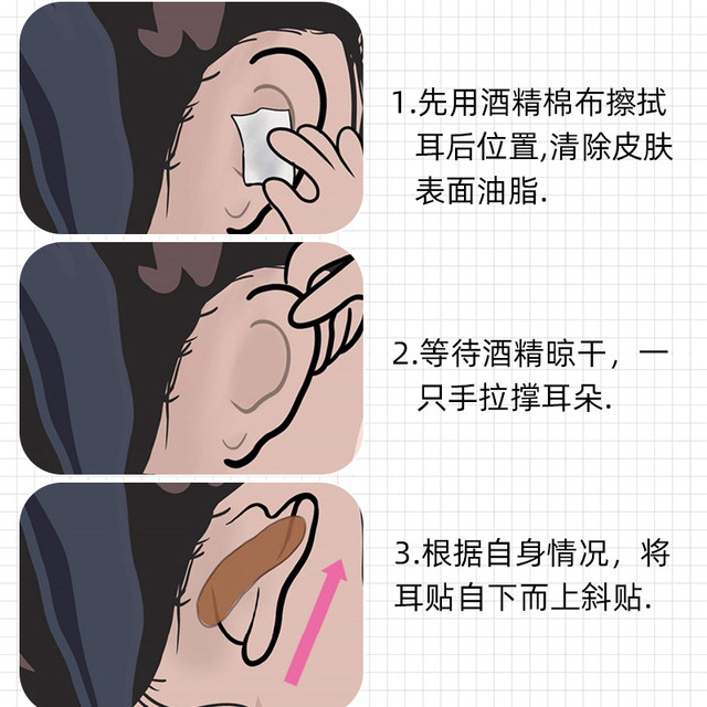 Butterfly Elf ear stickers provide strong support for girls, invisible face-revealing small fixed ear corrector, ear erecting and shaping artifact