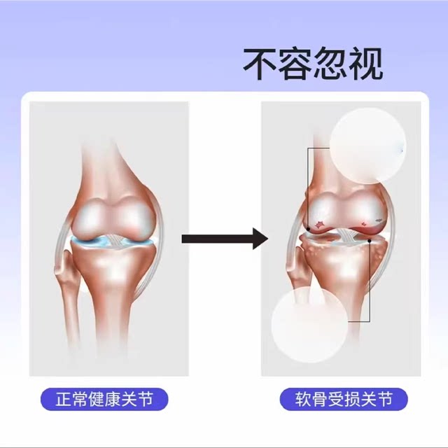 Nanjing Tongrentang Green Gold Home Non-denatured Type II Collagen Special Diet Official Flagship Store ZY