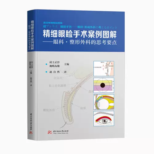 精细眼睑手术案例图解 新人首单立减十元 22年2月 淘宝海外