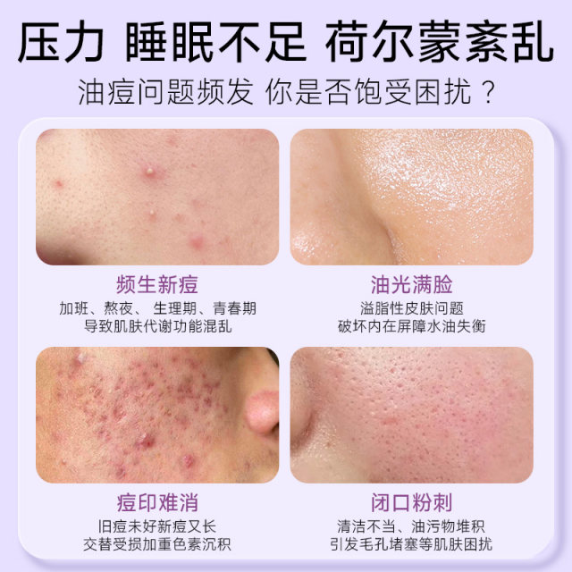 Australian Runkang Azeclear Cream Ren Er Polycrier Cream Repair Moisturizing Skin Skin Anti -Acne Azalea Cuckoo acid
