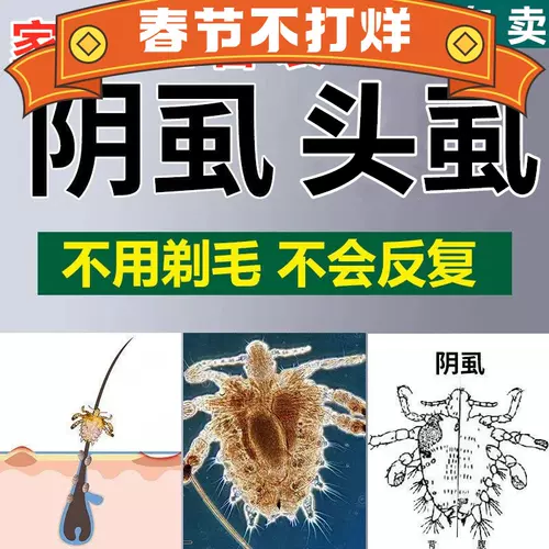 虱疥一扫光 新人首单立减十元 22年1月 淘宝海外