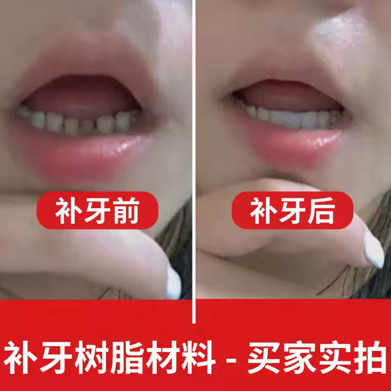 门牙假牙齿 新人首单立减十元 2021年11月 淘宝海外