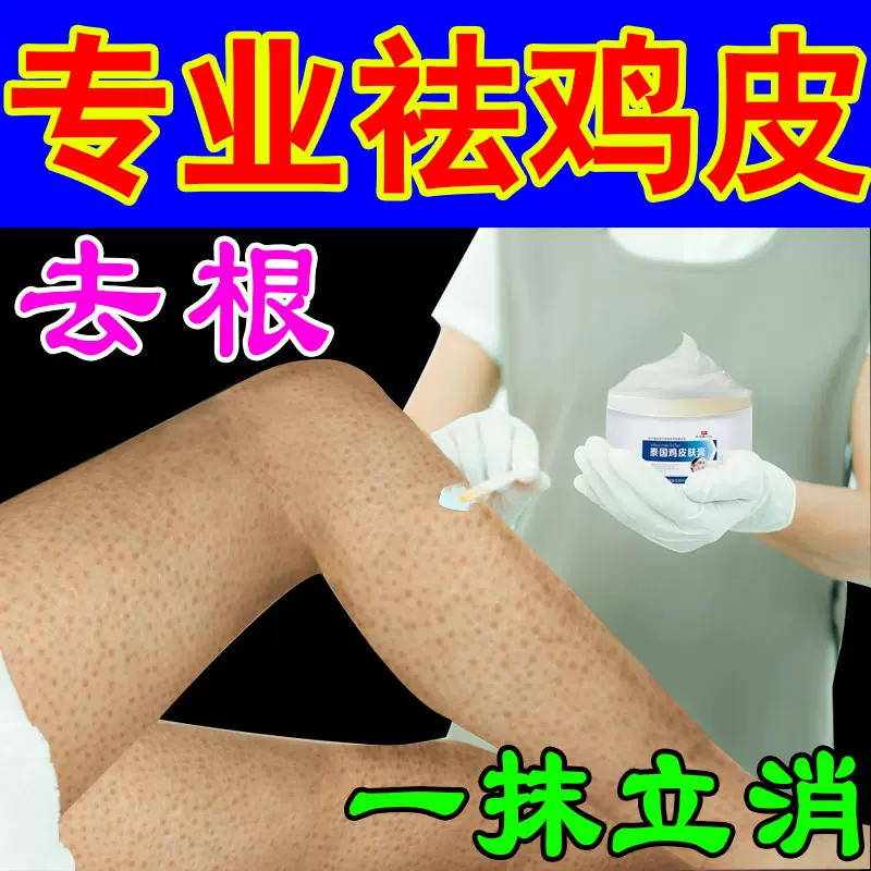 手臂疙瘩 新人首单立减十元 21年10月 淘宝海外