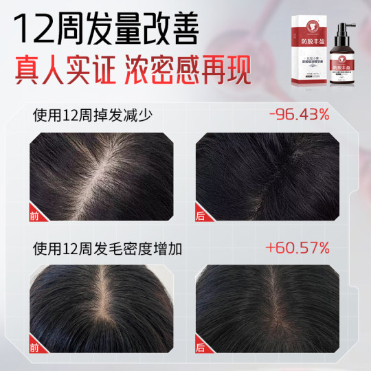 Changfa Xiaozhai Prevention and Deletion Serum Orchidopsis Leaf Polygonum multiflorum ginseng scalp men and women hair care liquid to prevent hair loss in China
