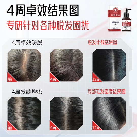 Changfa Xiaozhai Prevention and Deletion Serum Orchidopsis Leaf Polygonum multiflorum ginseng scalp men and women hair care liquid to prevent hair loss in China